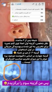 پست و کور ( دکتر رسایی پور ) 3 IMG 20230131 221822