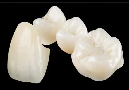 سرامیک دندانپزشکی