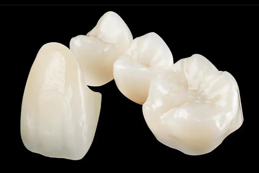 سرامیک دندانپزشکی