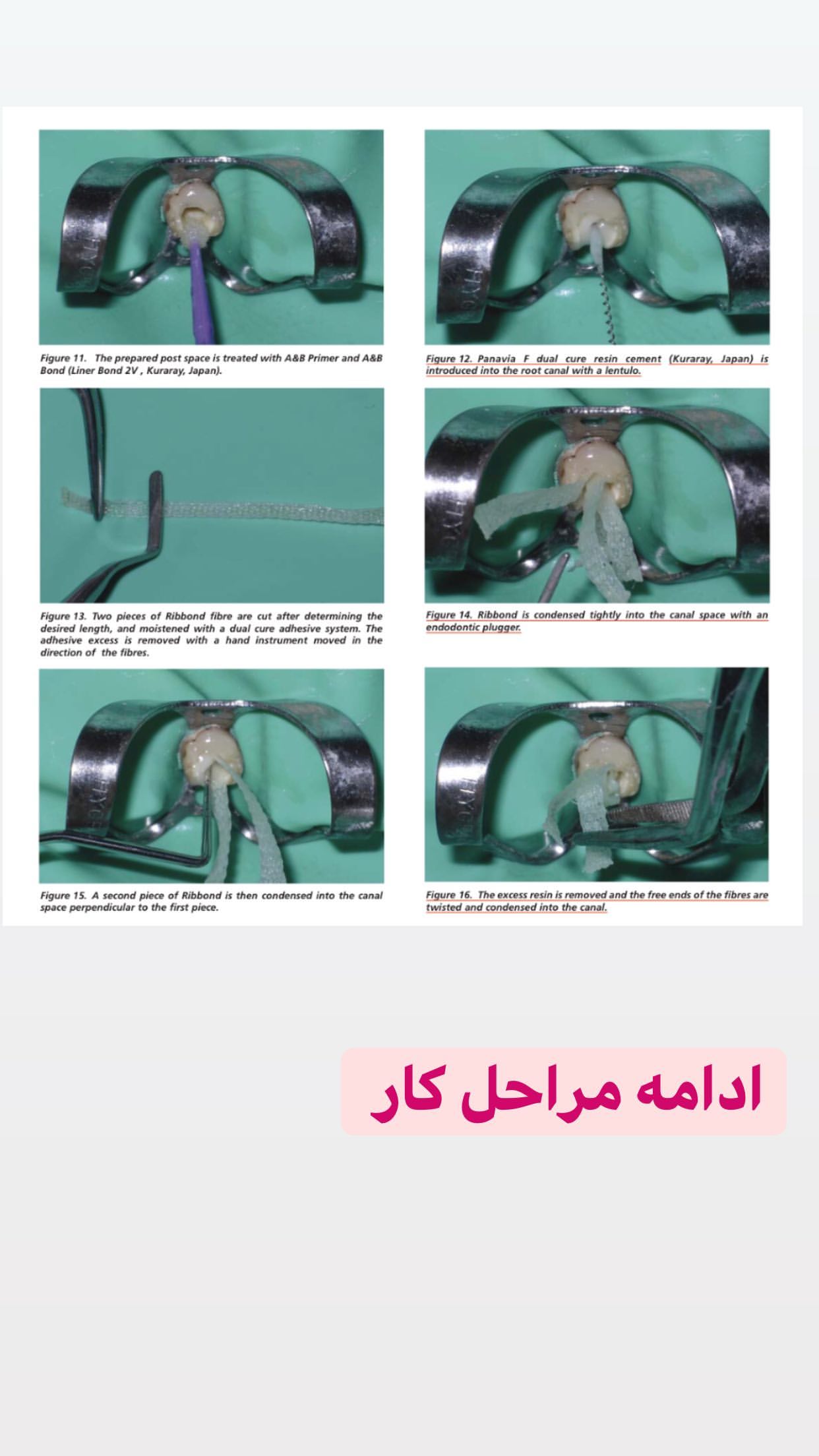 فایبرپست