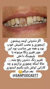 آفیس بلیچینگ (هایلایت دکتر نقیبی) 3 12 photo 1647091305 drseyedaminnaghibi RegramBot
