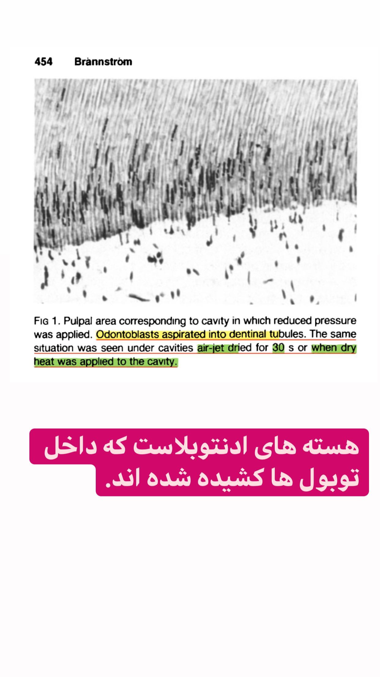 تئوری درد هیدرودینامیک