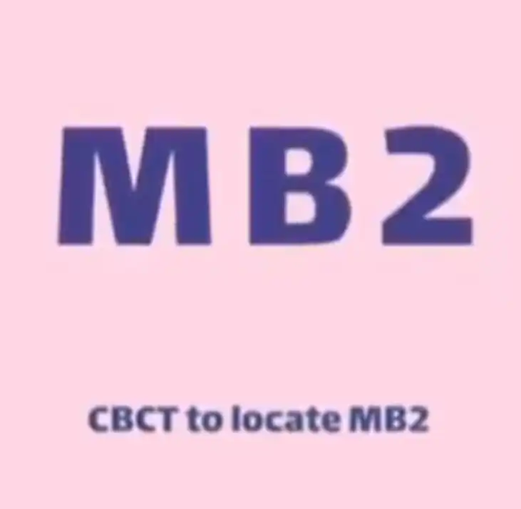 کانال mb2