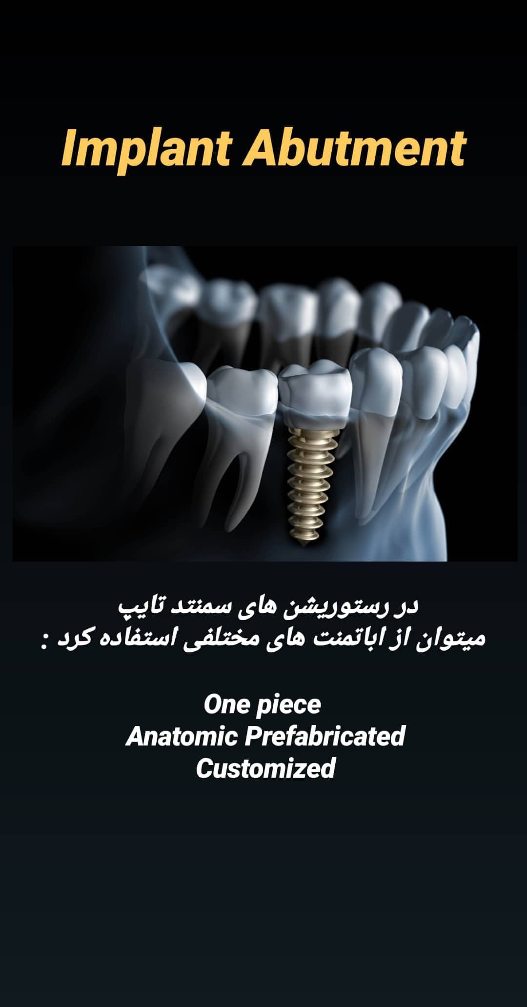 اباتمنت