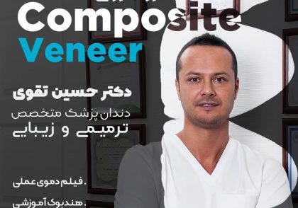 دوره آموزشی ونیر کامپوزیت دکتر تقوی