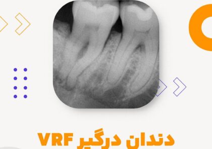 vrf