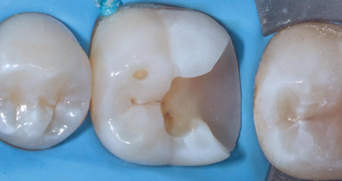 what is biomimetic dentistry 1