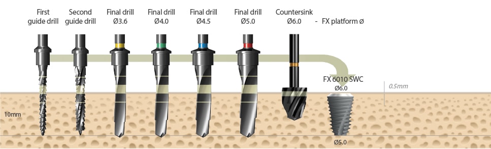 Drilling sequence in implantology