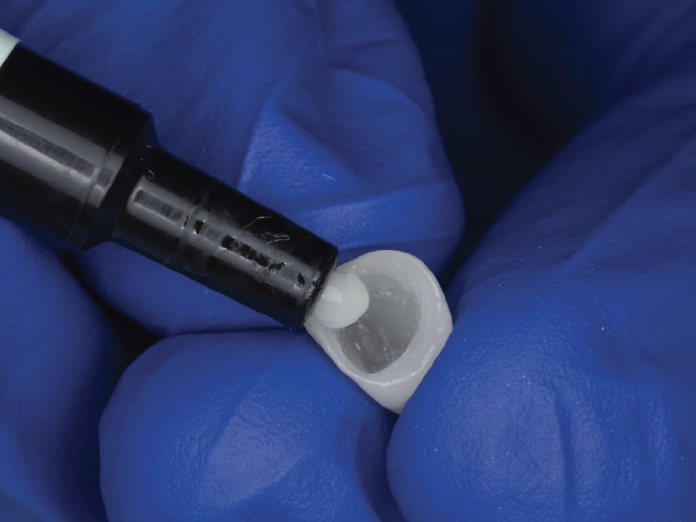 cementation