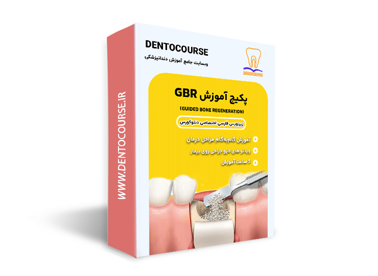 آموزش gbr