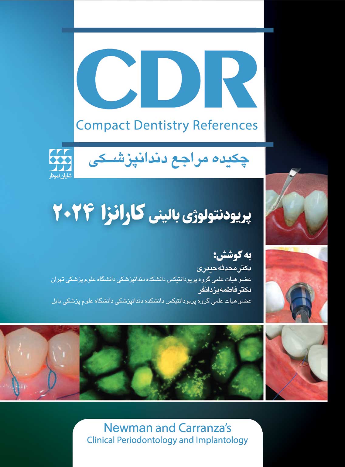 CDR پریودنتولوژی بالینی کارانزا 2024