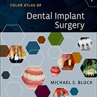 Color Atlas of Dental implant surgery