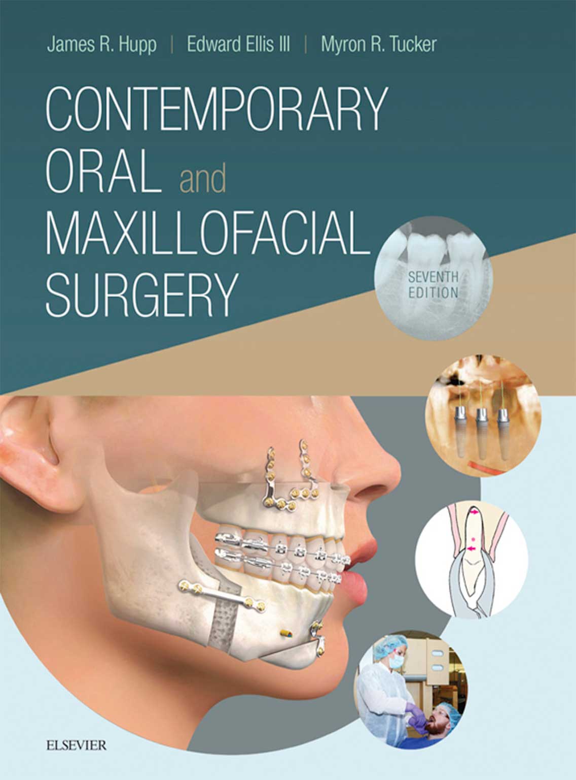 Contemporary Oral and Maxillofacial Surgery 1