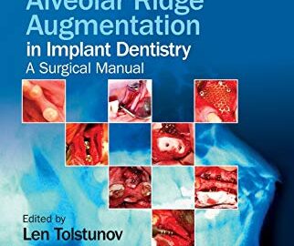 Horizontal Alveolar Ridge Augmentation in Implant Dentistry a surgical manual