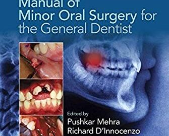 Manual of Minor Oral Surgery for the General Dentist