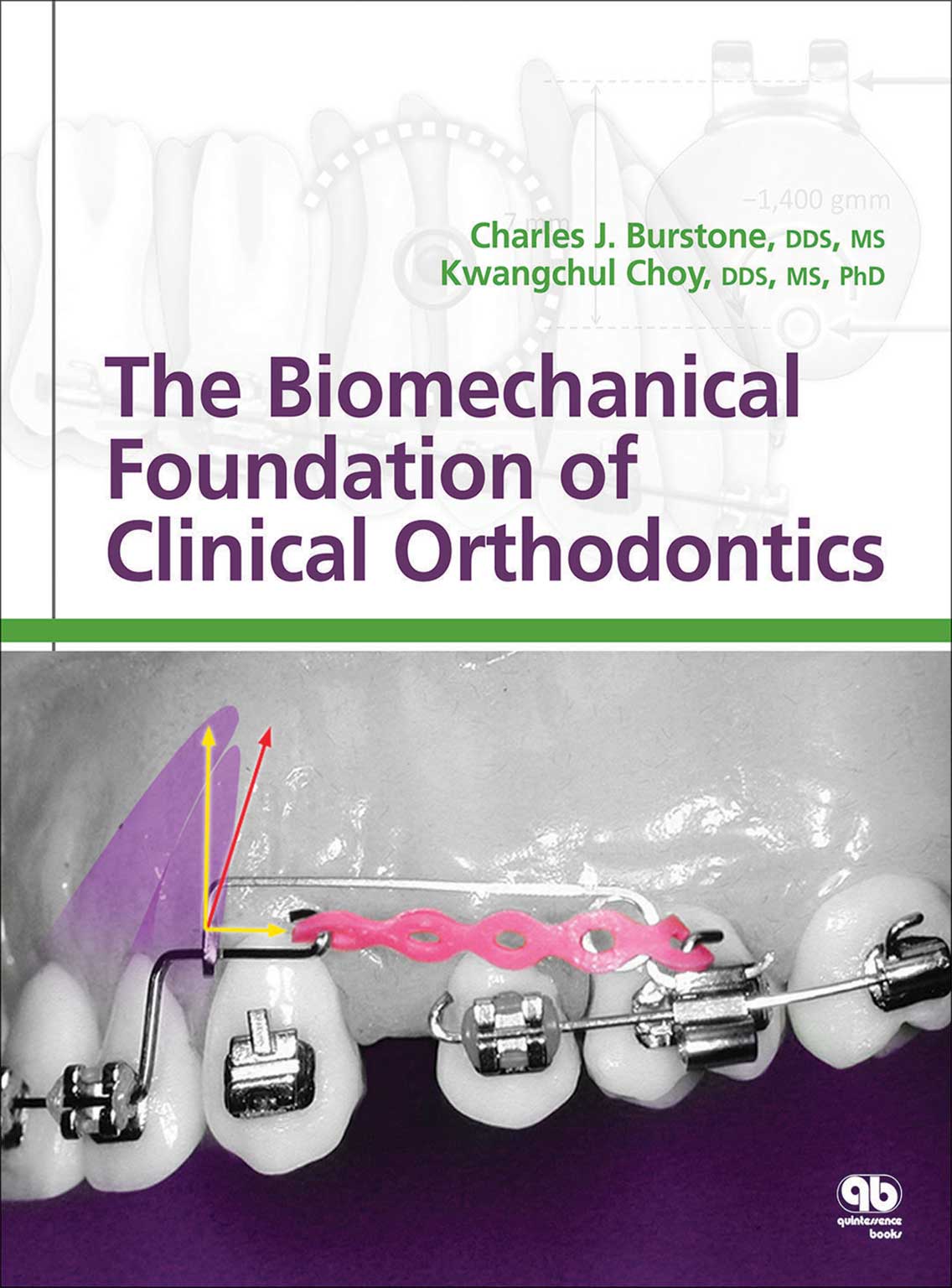 The Biomechanical Foundation of Clinical Orthodontics 2