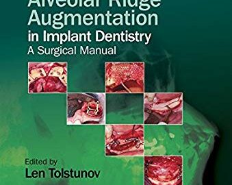 Vertical Alveolar Ridge Augmentation Implant Dentistry a surgical manual