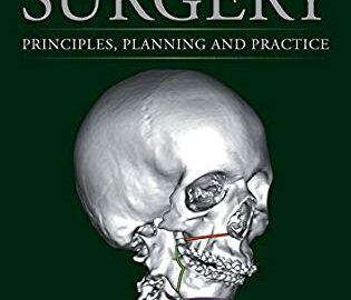 orthognathic surgery principles planning and practice
