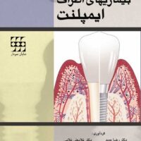 بیماریهای اطراف ایمپلنت