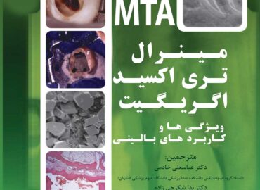تری اکسید