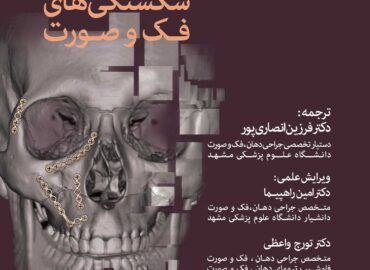 جراحی شکستگی