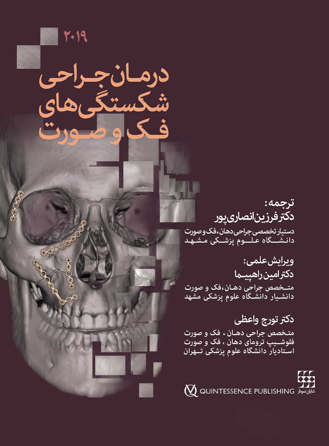 جراحی شکستگی