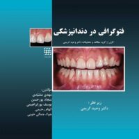 فتوگرافی در دندانپزشکی