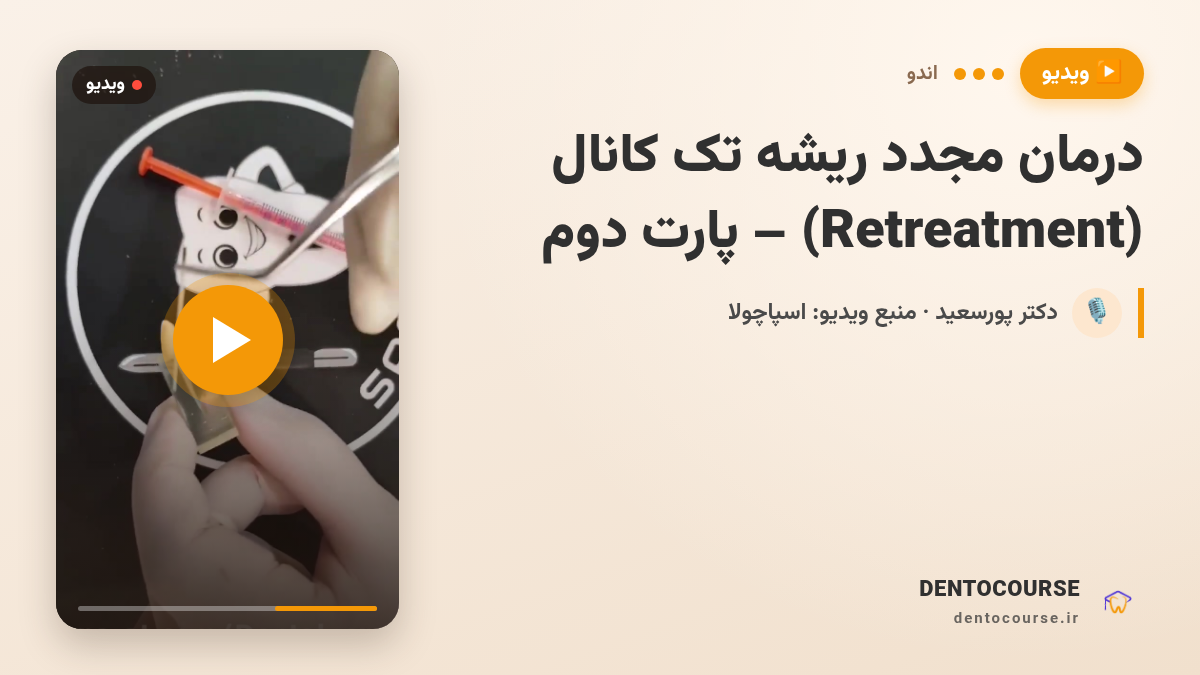 درمان مجدد ریشه تک کانال (Retreatment) | مراحل کامل کلینیکی (پارت دوم)
