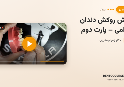 تراش روکش دندان قدامی | آموزش کامل کلینیکی (پارت دوم) با دکتر زهرا جعفریان