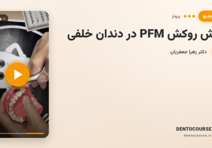 تراش روکش PFM در دندان خلفی | آموزش کامل با دکتر زهرا جعفریان