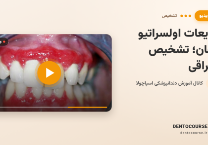 ضایعات اولسراتیو دهان | راهنمای کامل تشخیص افتراقی و رویکرد بالینی