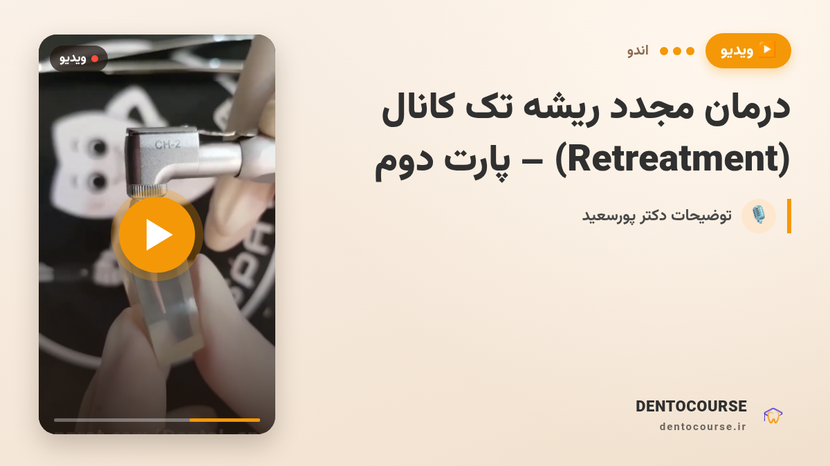 single canal retreatment 2