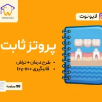 لایو نوت پروتز ثابت