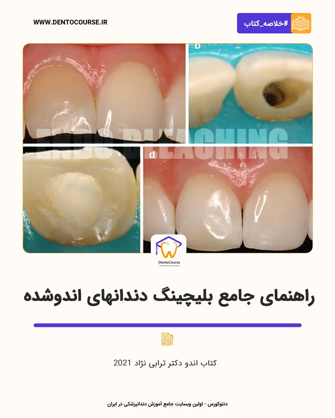 اندوبلیچ 01