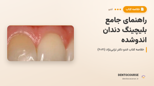 راهنمای جامع بلیچینگ دندان اندوشده