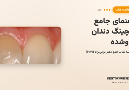 راهنمای جامع بلیچینگ دندان اندوشده