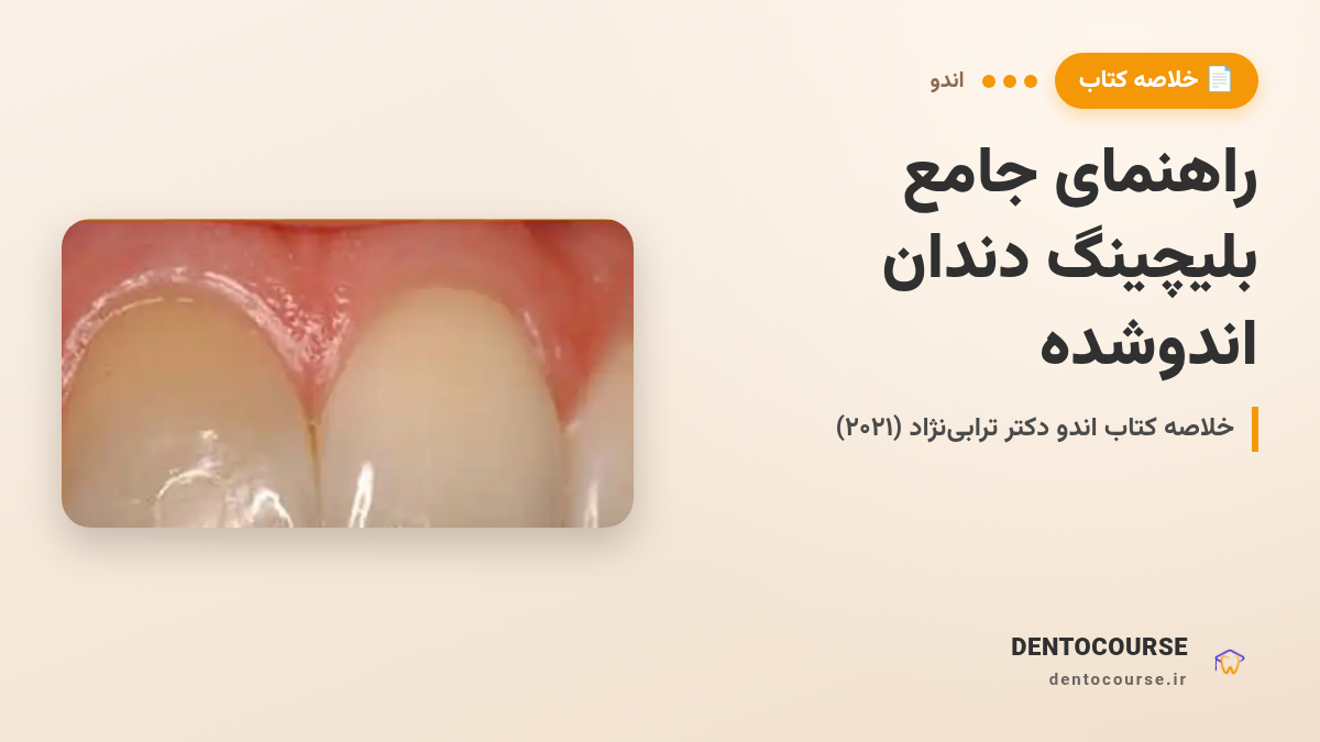 راهنمای جامع بلیچینگ دندان اندوشده