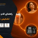 تشخیص در اندو