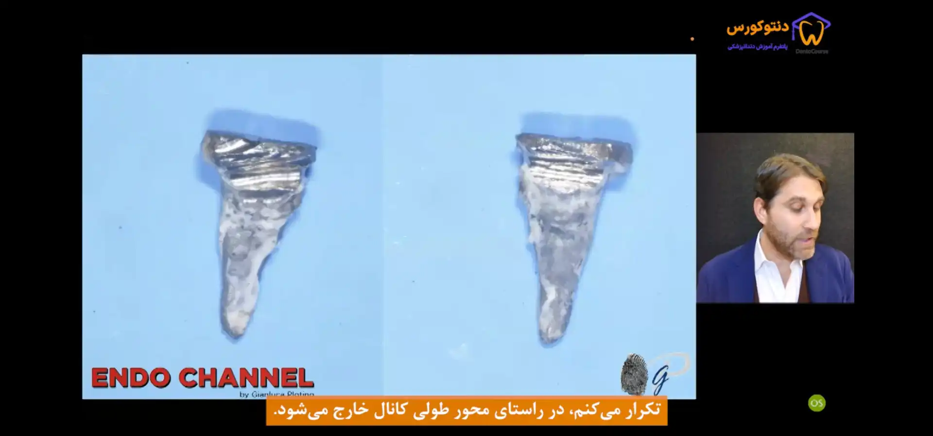 خارج کردن پست فلزی