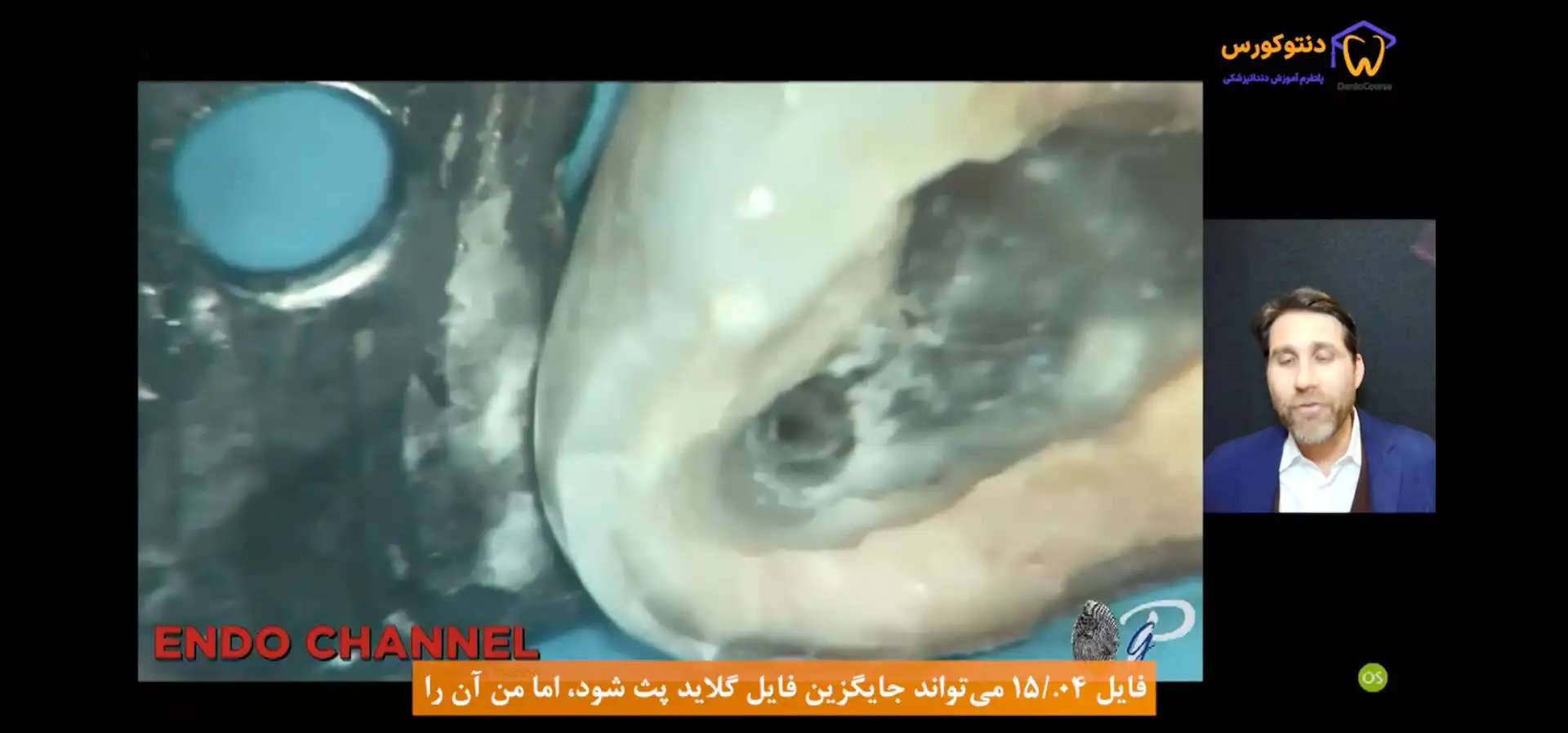 پیدا کردن کانال میسشده