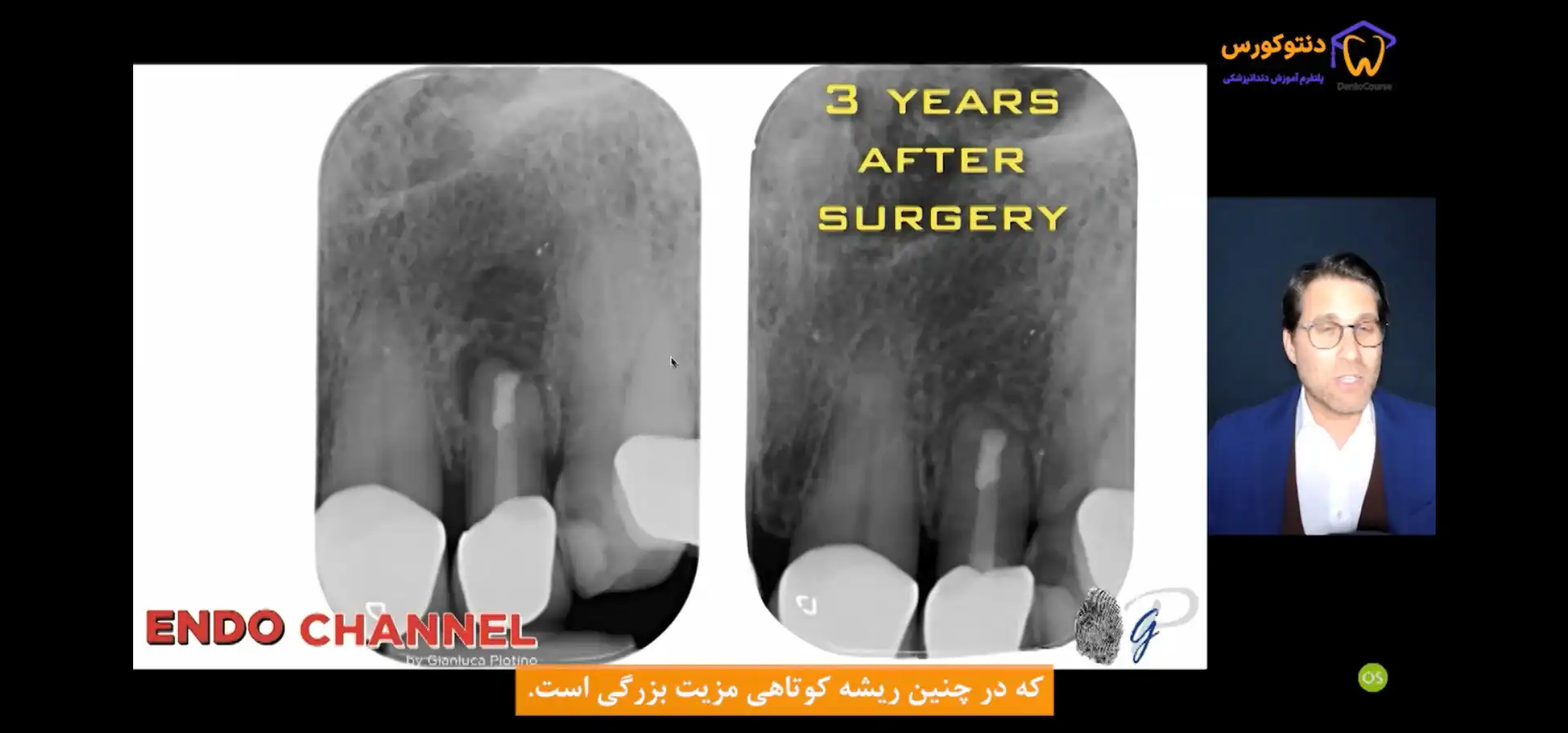 مدیریت اپکس باز