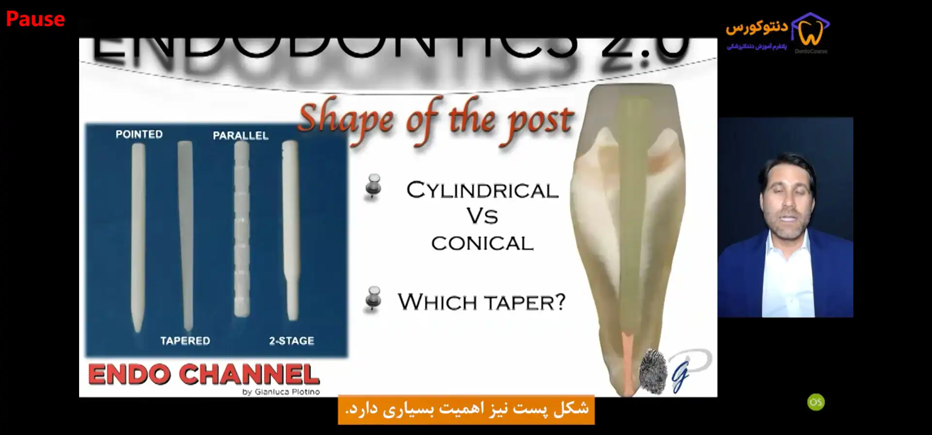بازسازی دندان اندو شده