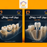 دنتوبوک پروتز ثابت رزونتال | خلاصه جامع Fixed Prosthodontics در ۲ جلد