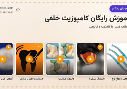 ۵ آموزش رایگان کامپوزیت خلفی در دنتوکورس؛ از انتخاب کیس تا کانتکت و آناتومی