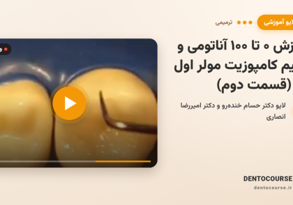 23 anatomy upmolar 2