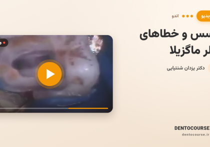 33 access molar maxilla