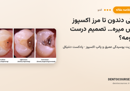 49 deep caries management and exposed pulp