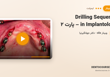 69 drilling sequence implantology part 2