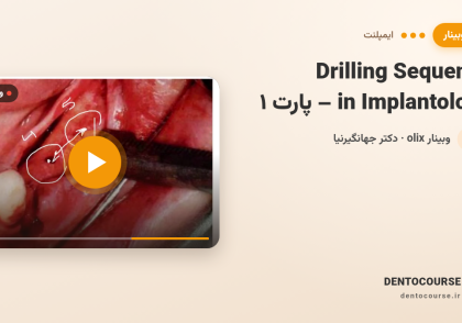 70 drilling sequence implantology part 1