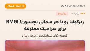 انتخاب سمان در پروتز ثابت؛ تصویر بالینی Fig 30.12H از پروتز رزنتال
